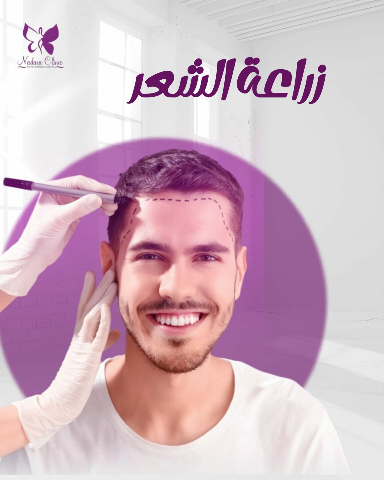 زراعة الشعر